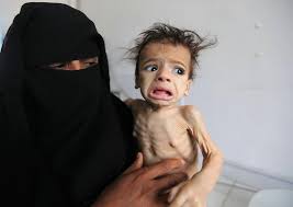 famine yemen